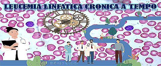 Leucemia linfatica cronica