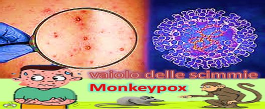 Monkeypox -Vaiolo delle scimmie